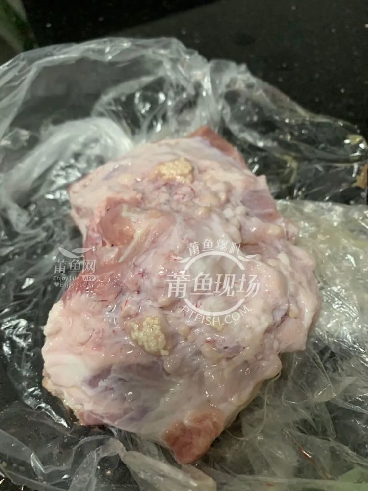 美国男子因食用未煮熟猪肉引发健康危机，食品安全警钟长鸣