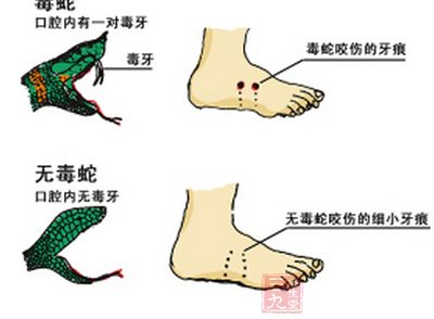 毒蛇咬伤急救指南，如何为家人提供正确救援措施