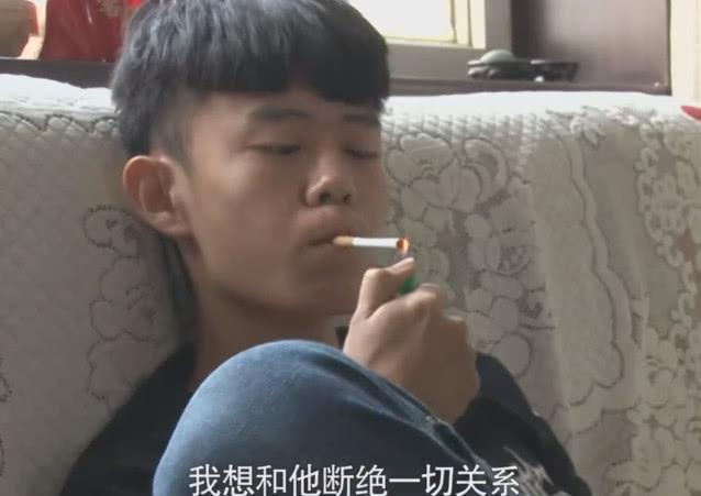 探究青少年秃头现象，与众不同的青春挑战